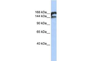WB Suggested Anti-TOP2B Antibody Titration:  0. (TOP2B anticorps  (Middle Region))