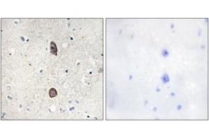 Immunohistochemistry analysis of paraffin-embedded human brain, using IGFBP-3 (Phospho-Ser183) Antibody. (IGFBP3 anticorps  (pSer183))