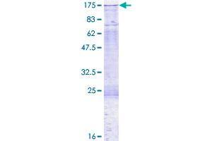 Image no. 1 for DNA (Cytosine-5-)-Methyltransferase 3 alpha (DNMT3A) (AA 1-912) protein (GST tag) (ABIN1351867)