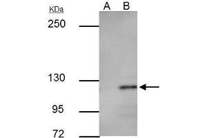 IP Image E-cadherin antibody immunoprecipitates E-cadherin protein in IP experiments.