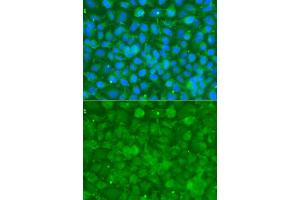 Immunofluorescence analysis of A549 cells using SERPINA3 antibody. (SERPINA3 anticorps  (AA 24-423))