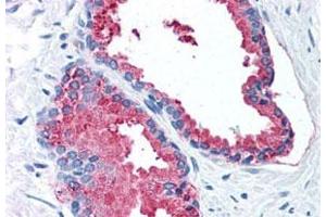 Immunohistochemistry (Formalin/PFA-fixed paraffin-embedded sections) of human prostate with LOXL2 polyclonal antibody . (LOXL2 anticorps  (Internal Region))