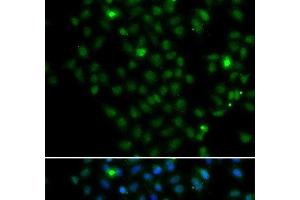 Immunofluorescence analysis of MCF-7 cells using LMO4 Polyclonal Antibody (LMO4 anticorps)
