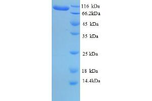 SDS-PAGE (SDS) image for Eukaryotic Translation Elongation Factor 2 (EEF2) (AA 2-858) protein (His tag) (ABIN5709437)