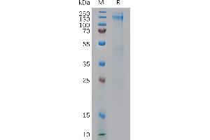 Human IGF-1R Protein, His Tag on SDS-PAGE under reducing condition.