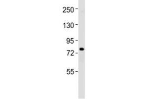 Western blot testing of ERCC2 antibody at 1:1000 dilution + K562 lysate
