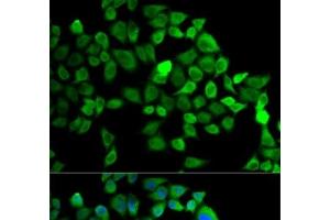 Immunofluorescence analysis of MCF-7 cells using CUL2 Polyclonal Antibody (Cullin 2 anticorps)