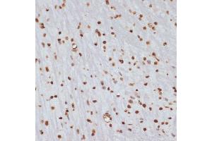 Immunohistochemistry of paraffin-embedded mouse brain using Phospho-Chk1-S280 antibody (ABIN3019445, ABIN3019446, ABIN3019447 and ABIN6225372) at dilution of 1:100 (40x lens). (CHEK1 anticorps  (pSer280))