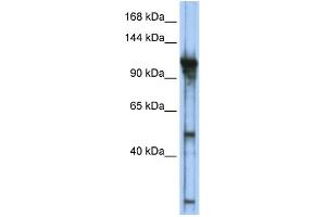 WB Suggested Anti-GTF3C2 Antibody Titration:  0. (GTF3C2 anticorps  (Middle Region))