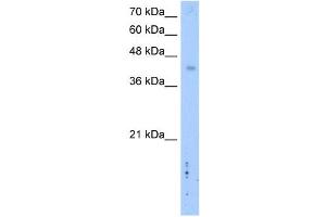 WB Suggested Anti-LRRC2 Antibody Titration: 2. (LRRC2 anticorps  (C-Term))