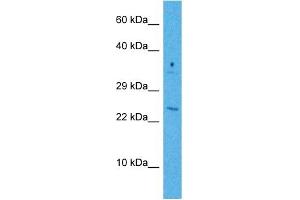 Host:  Rabbit  Target Name:  GADD45B  Sample Tissue:  Human Jurkat Whole Cell  Antibody Dilution:  1ug/ml