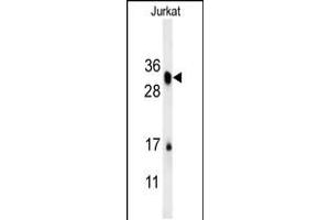 Western blot analysis in Jurkat cell line lysates (15ug/lane). (R-Spondin 4 anticorps  (C-Term))