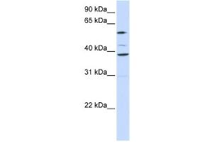 Western Blotting (WB) image for anti-Solute Carrier Family 25 (Mitochondrial Carrier, Graves Disease Autoantigen), Member 16 (SLC25A16) antibody (ABIN2458815) (SLC25A16 anticorps)