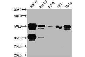 Western Blot Positive WB detected in: MCF-7 whole cell lysate, HepG2 whole cell lysate, PC-3 whole cell lysate, 293 whole cell lysate, Hela whole cell lysate All lanes: FOXA1 antibody at 1:2000 Secondary Goat polyclonal to rabbit IgG at 1/50000 dilution Predicted band size: 50, 46 kDa Observed band size: 50 kDa (Recombinant FOXA1 anticorps)