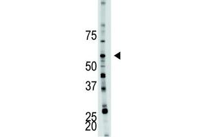 Western Blotting (WB) image for anti-6-phosphofructo-2-Kinase/fructose-2,6-Biphosphatase 4 (PFKFB4) antibody (ABIN3003725) (PFKFB4 anticorps)
