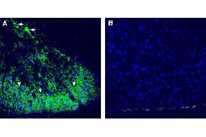Expression of CALHM2 in rat spinal cord. (CALHM2 anticorps  (Extracellular))