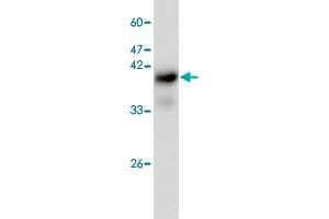 Western blot analysis of H520 whole cell lystae with IST1 monoclonal antibody, clone 22  at 1:1000 dilution. (IST1 anticorps)