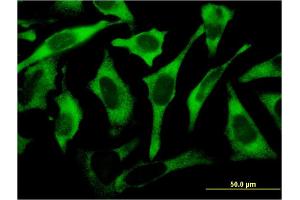 Immunofluorescence of monoclonal antibody to RPL17 on HeLa cell.