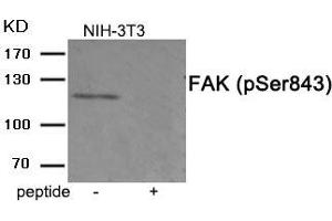 Western blot analysis of extracts from 3T3 cells treated with PMA using Phospho-FAK (Ser843) antibody. (FAK anticorps  (pSer843))