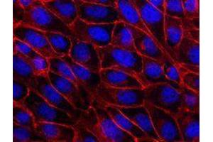 Immunofluorescence (IF) image for anti-Cadherin 1, Type 1, E-Cadherin (Epithelial) (CDH1) antibody (ABIN2664571)