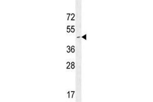 CD34 antibody western blot analysis in Jurkat lysate.