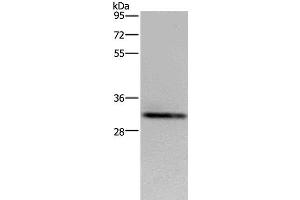 Western Blot analysis of OP9 cell using CD242 Polyclonal Antibody at dilution of 1:500 (ICAM4 anticorps)