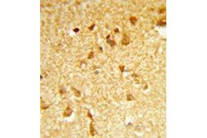 Formalin-fixed and paraffin-embedded human brain tissue reacted with DDX17 Antibody (N-term) followed which was peroxidase-conjugated to the secondary antibody, followed by DAB staining. (DDX17 anticorps  (N-Term))