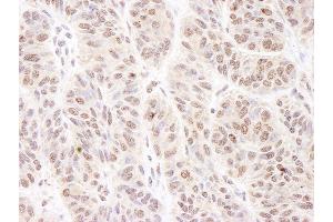 anti-BCL2-Associated Transcription Factor 1 (BCLAF1) (C-Term) antibody
