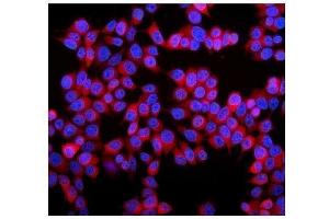 IF analysis of Stathmin 1 using anti-Stathmin 1 antibody (ABIN3043301). (Stathmin 1 anticorps  (N-Term))