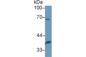 Detection of DLAT in Mouse Mastadenoma lysate using Polyclonal Antibody to Dihydrolipoyl Transacetylase (DLAT) (DLAT anticorps  (AA 368-626))