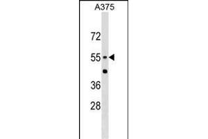 CNDP1 Antibody (Center) (ABIN1537860 and ABIN2849250) western blot analysis in  cell line lysates (35 μg/lane). (CNDP1 anticorps  (AA 142-170))