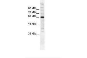 Image no. 1 for anti-Polymerase (RNA) II (DNA Directed) Polypeptide B, 140kDa (POLR2B) (AA 119-168) antibody (ABIN202976) (POLR2B anticorps  (AA 119-168))
