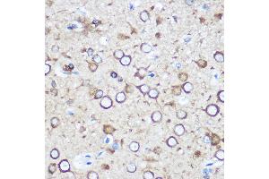 Immunohistochemistry of paraffin-embedded Rat brain using EY Rabbit pAb (ABIN6135167, ABIN6140386, ABIN6225031 and ABIN6225033) at dilution of 1:100 (40x lens). (EYA1 anticorps  (AA 100-250))