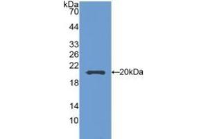 Detection of Recombinant SEMA5B, Mouse using Polyclonal Antibody to Semaphorin 5B (SEMA5B)