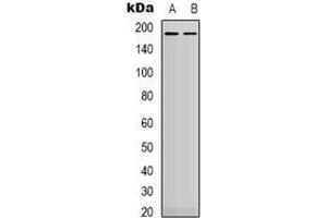 Western blot analysis of HER2 expression in MDA (A), SKOV3 (B) whole cell lysates. (ErbB2/Her2 anticorps  (C-Term))
