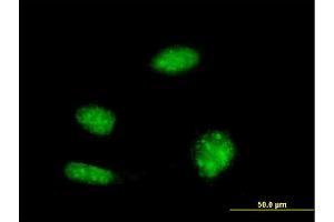 Immunofluorescence of monoclonal antibody to KHSRP on HeLa cell.