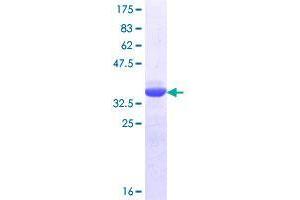 Image no. 1 for CREB Regulated Transcription Coactivator 1 (CRTC1) (AA 553-634) protein (GST tag) (ABIN1350404)