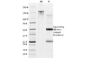 SDS-PAGE Analysis Purified CD28 Mouse Monoclonal Antibody (CB28).