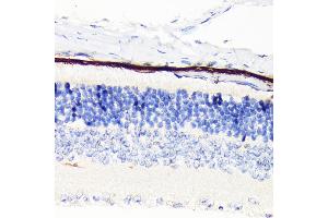 Immunohistochemistry of paraffin-embedded mouse retina using RPE65 Rabbit mAb (ABIN7269933) at dilution of 1:100 (40x lens). (RPE65 anticorps)
