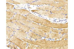 Immunohistochemistry analysis of parafffin-embedded rat skeletal muscle using Desmin Monoclonal Antibody at dilution of 1:300.