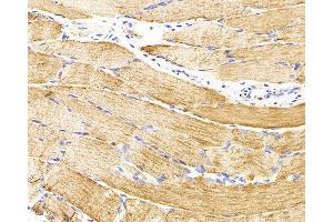 Immunohistochemistry analysis of parafffin-embedded rat skeletal muscle using Desmin Monoclonal Antibody at dilution of 1:300. (Desmin anticorps)