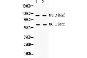 Western blot analysis of ADAM28 using anti-ADAM28 antibody . (ADAM28 anticorps  (N-Term))