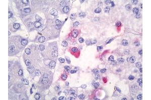 Anti-Somatostatin antibody IHC of human pancreas.