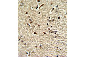 Formalin-fixed and paraffin-embedded human brain tissue reacted with PAX4 Antibody , which was peroxidase-conjugated to the secondary antibody, followed by DAB staining. (PAX4 anticorps  (AA 171-200))