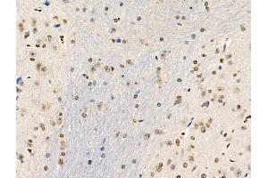 Phospho-Tryptophan Hydroxylase (Ser58) Antibody at 1/100 staining Mouse brain tissue by IHC-P.