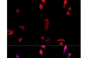 Immunofluorescence analysis of NIH/3T3 cells using EIF3J Polyclonal Antibody at dilution of 1:100. (EIF3S1 anticorps)