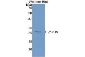 Western Blotting (WB) image for anti-Actin Related Protein 2/3 Complex, Subunit 4, 20kDa (ARPC4) (AA 3-165) antibody (ABIN1858081) (ARPC4 anticorps  (AA 3-165))