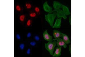 ABIN6256428 and ABIN6267317 staining Hela cells by IF/ICC. (Retinoblastoma Protein (Rb) anticorps  (pSer807))