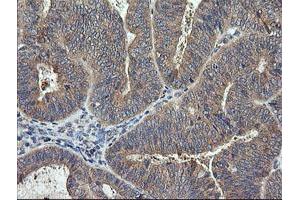 Image no. 1 for anti-Ras Homolog Gene Family, Member J (RHOJ) antibody (ABIN1501341)