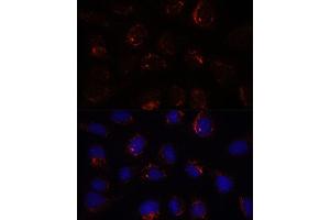 Immunofluorescence analysis of U-2 OS cells using BZW2 antibody (ABIN7265831) at dilution of 1:100.
